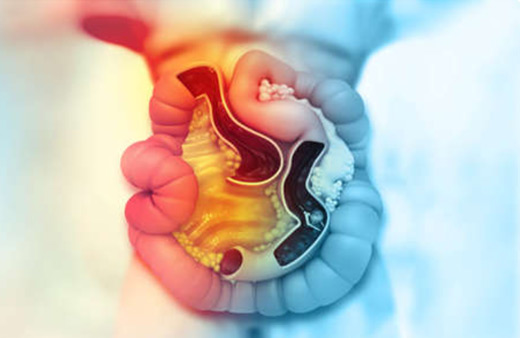 QFit Bowel Cancer Home Test Kit UK